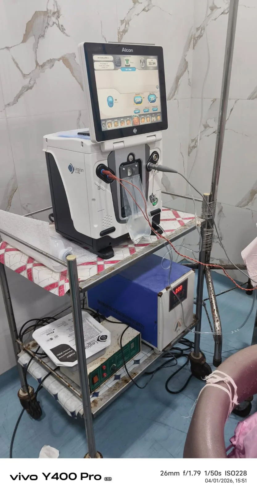 Alcon Legion Phacoemulsification Cataract Surgery System at Dr. Reddy's Karaikal