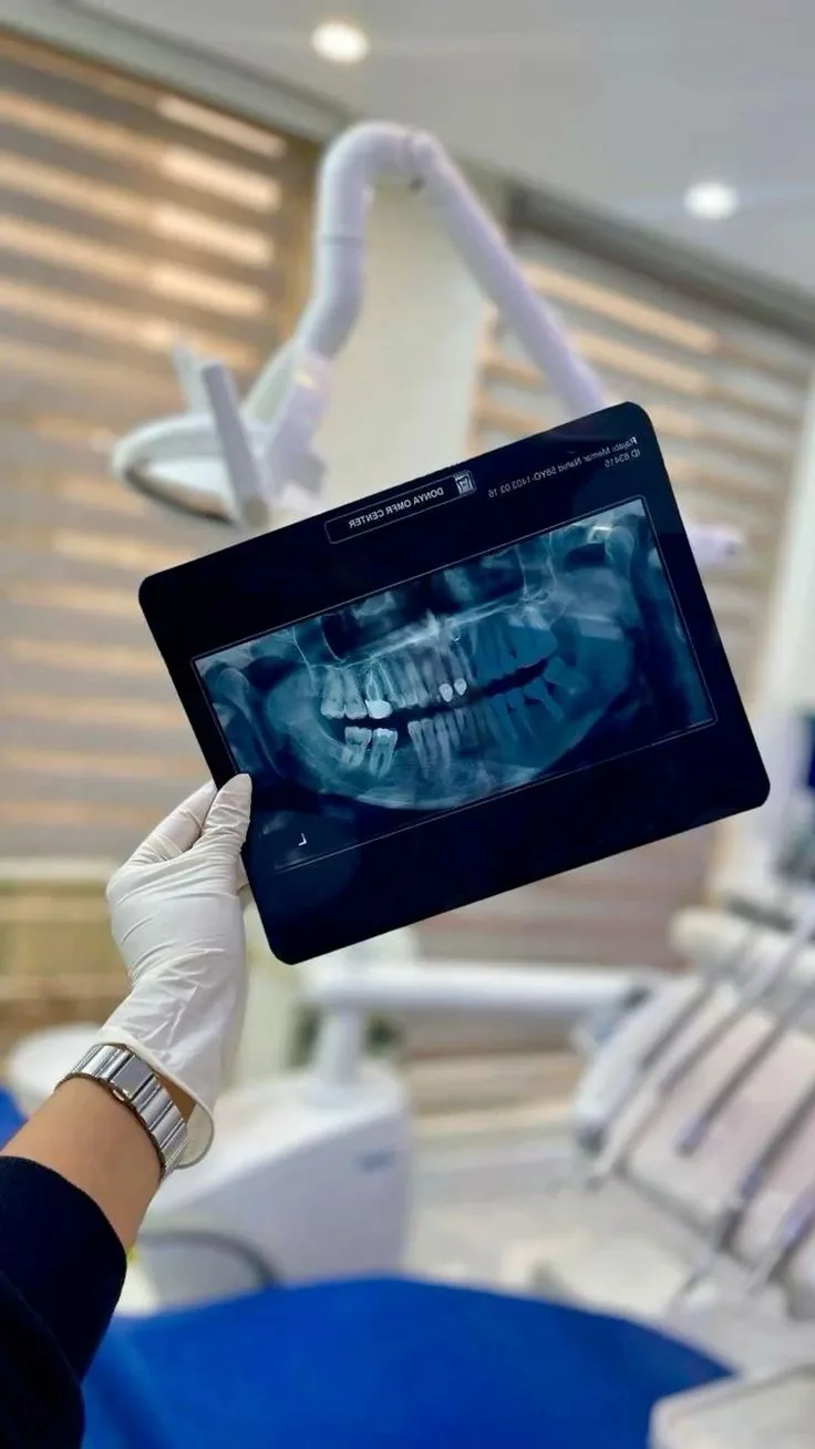 Dental X-Ray & OPG Diagnosis at Dr. Reddy's Karaikal