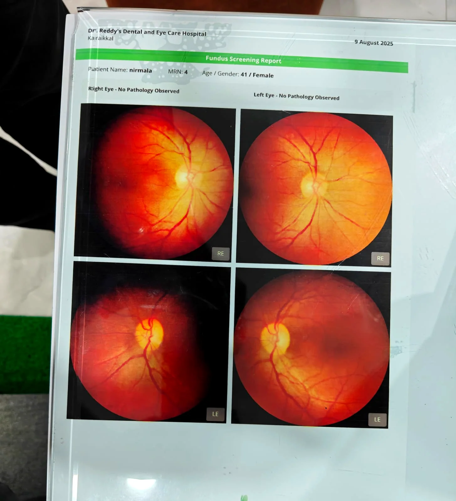 Real Fundus Retina Screening Report from Dr. Reddy's Dental & Eye Hospital Karaikal